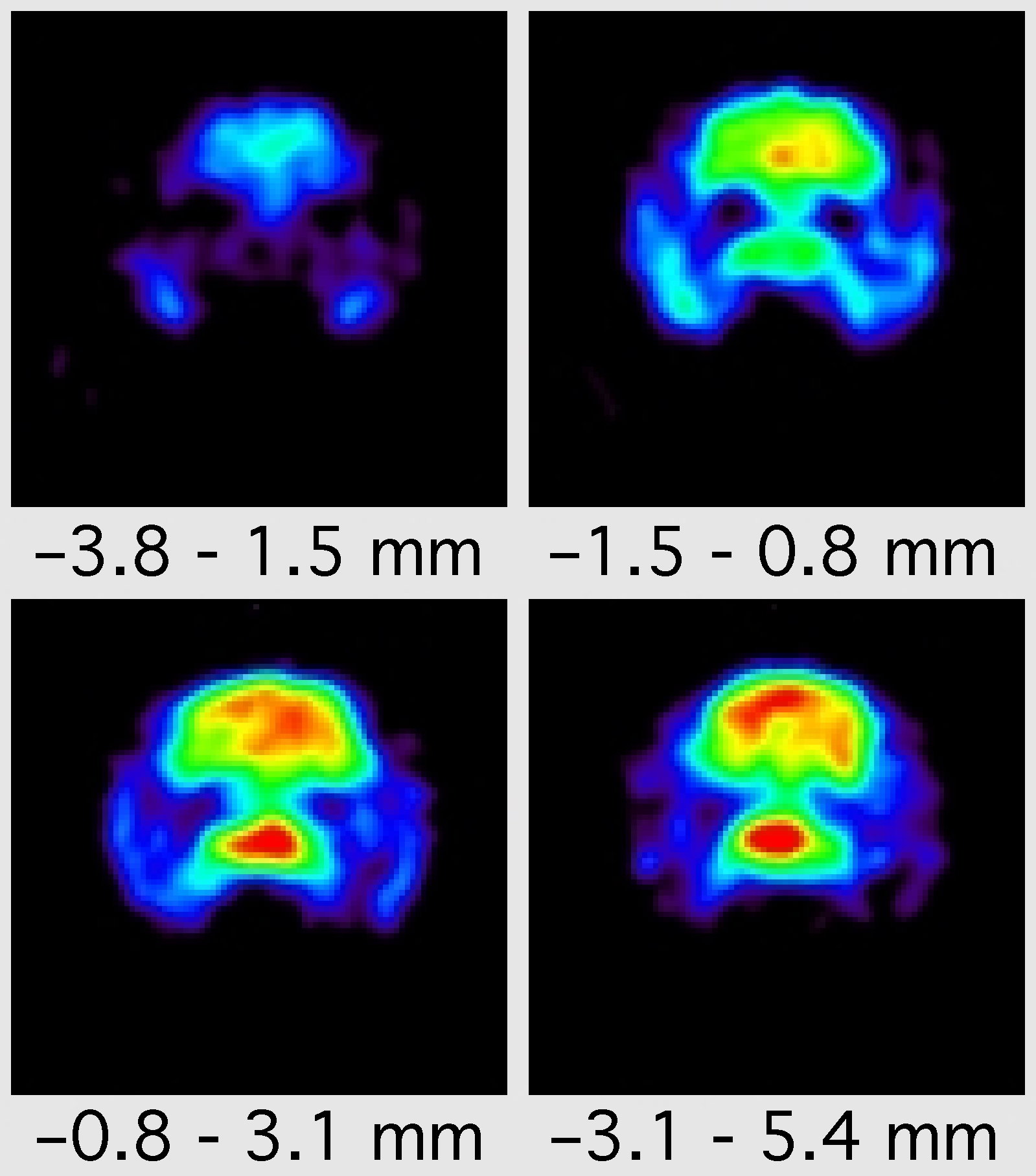 Rat brain 18FDG scan