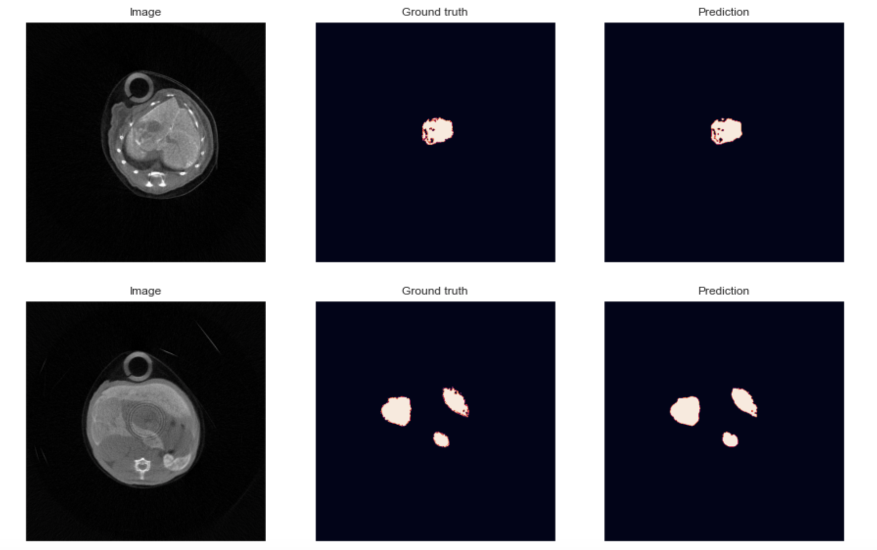 Unet_segment